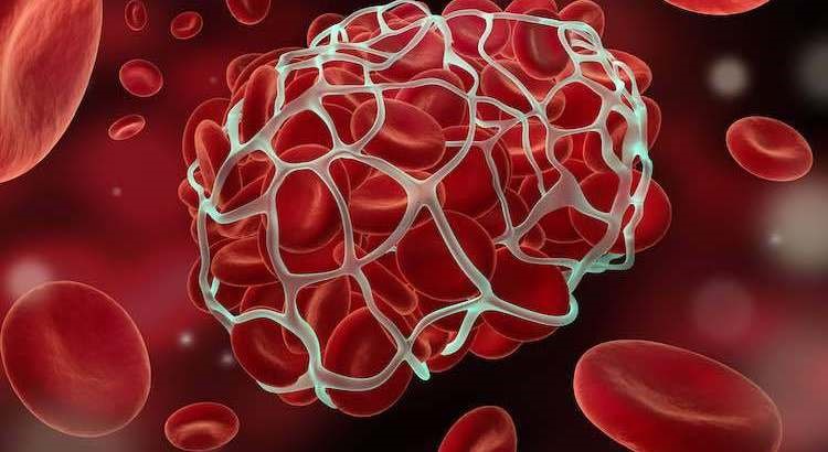 Thrombophilia Profile